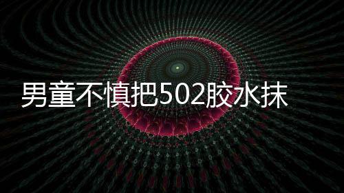 男童不慎把502胶水抹嘴巴胳膊上 母亲：浸泡一夜已自行脱落